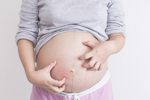 苏州哪家医院可以做试管婴儿-孕妇下体肿胀